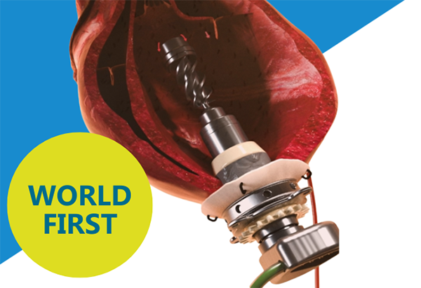 K SHOW 2025进行时 | 威格斯邀您共赴创新之旅